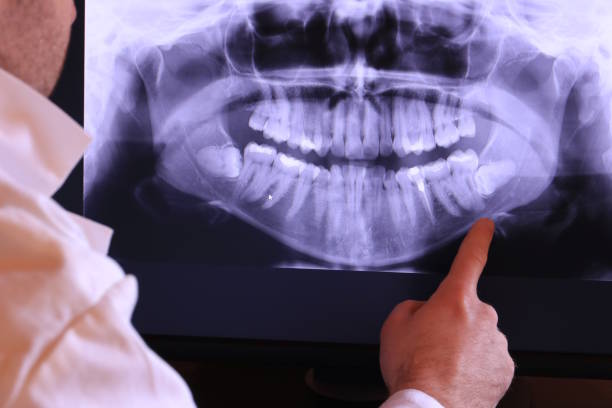 Best Knocked-Out Tooth Emergency  in Abaster, AL